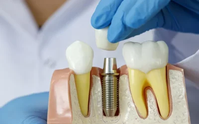 La nécessité de soins dentaires moins cher pour les patients français