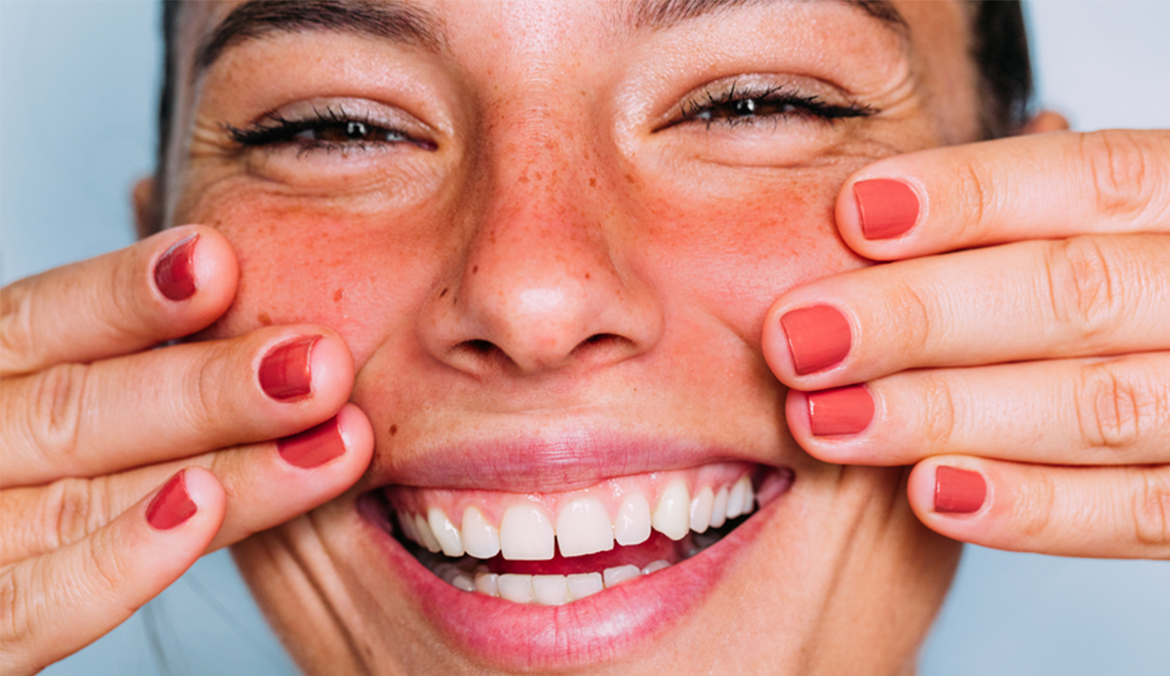 "Je suis dermatologue et voici ce que je veux que vous sachiez sur les différences entre l'acné et la rosacée"
