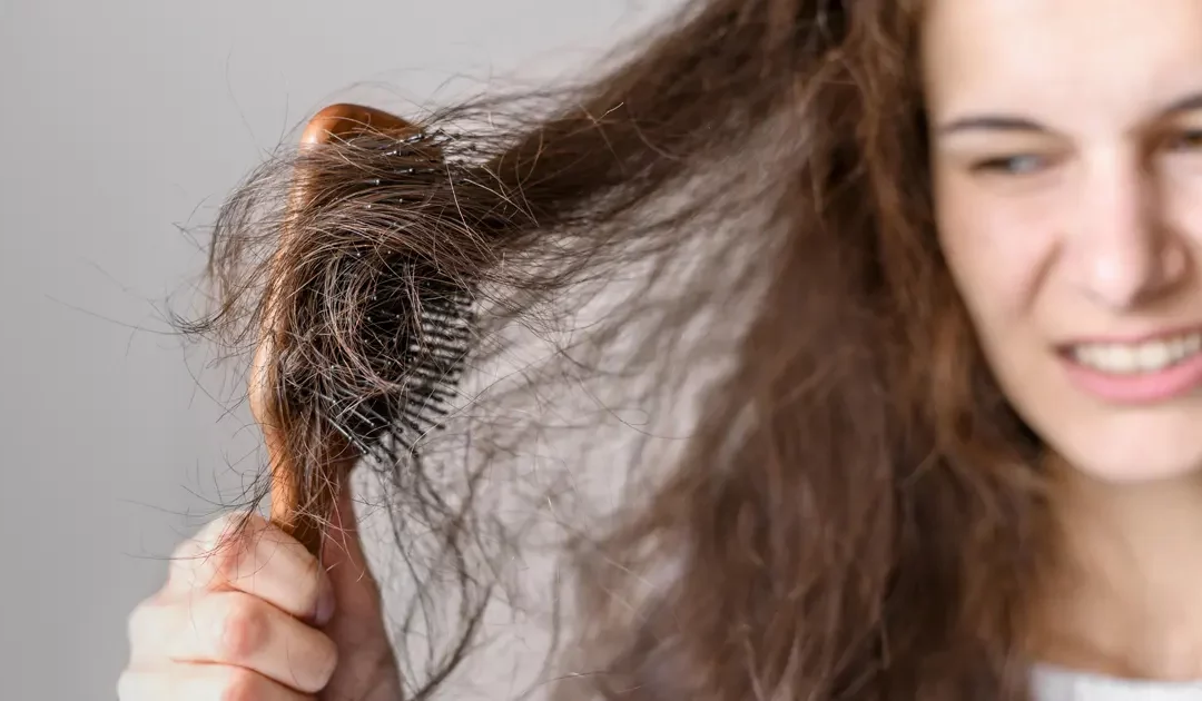 Quel est le meilleur traitement contre la chute de cheveux : la greffe de cheveux ou les injections de PRP ?